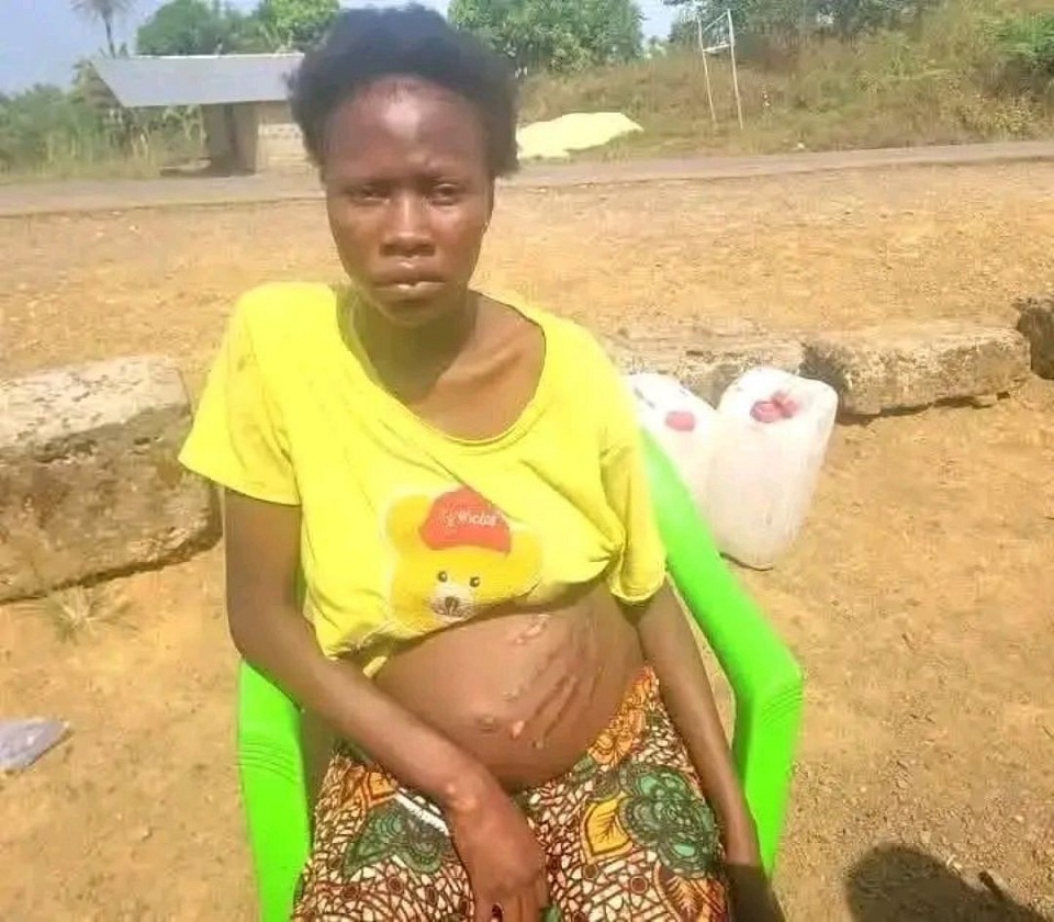 Mayi uyu akuti usiku amalota Muthu amene anamukana chibwezi atampatsa mbama pamimba ndipo mawa kutacha anapeza zidindo zazala ngati momwe mukuwonekanu kukhala tizitelo Kodi?